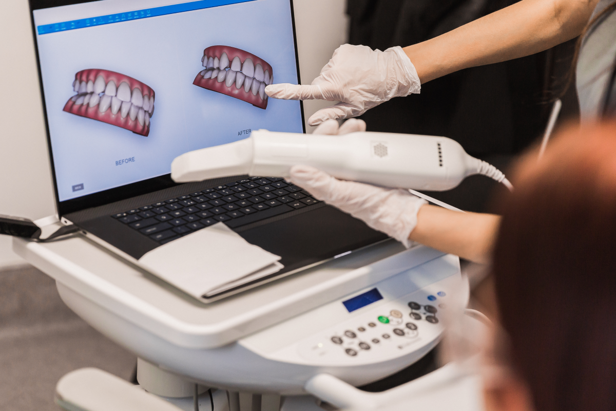 empreinte numerique dentaire Nos technologies Dr Johan Cinçon - Chirurgien-dentiste à La Teste-de-Buch